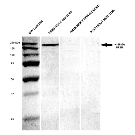 Western Blot - Anti-NMDAR2B Antibody [S59] (A304796) - Antibodies.com