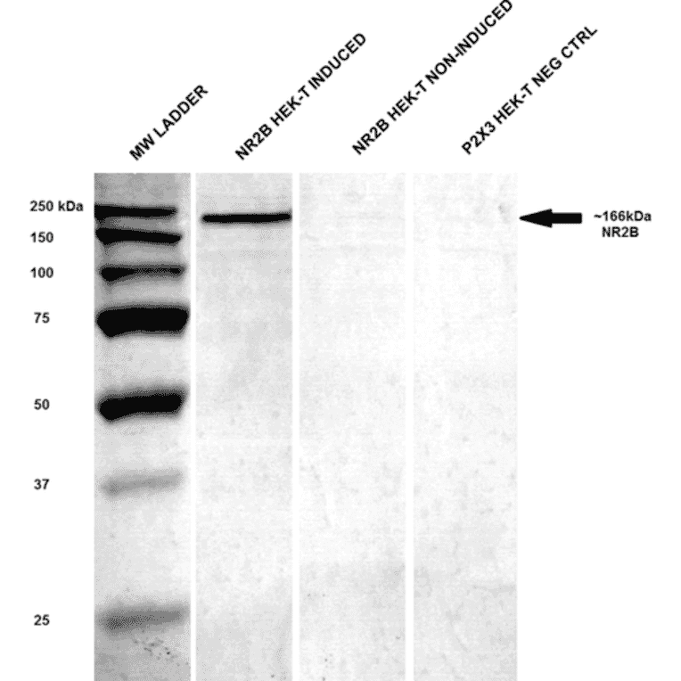 Western Blot - Anti-NMDAR2B Antibody [S59] (A304796) - Antibodies.com