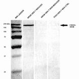 Western Blot - Anti-NMDAR2B Antibody [S59] (A304796) - Antibodies.com