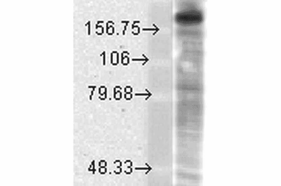 Western Blot - Anti-NMDAR2B Antibody [S59] (A304796) - Antibodies.com