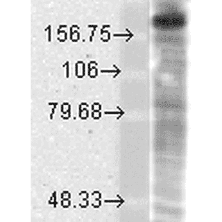 Western Blot - Anti-NMDAR2B Antibody [S59] (A304796) - Antibodies.com