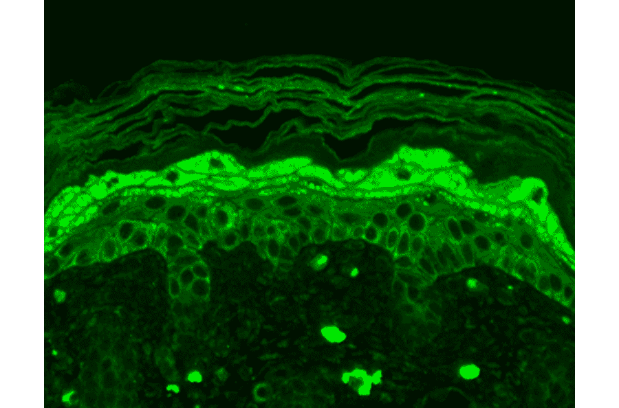 Immunohistochemistry - Anti-NMDAR2B Antibody [S59] (A304796) - Antibodies.com