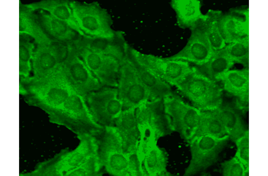 Immunocytochemistry/Immunofluorescence - Anti-NMDAR2B Antibody [S59] (A304796) - Antibodies.com