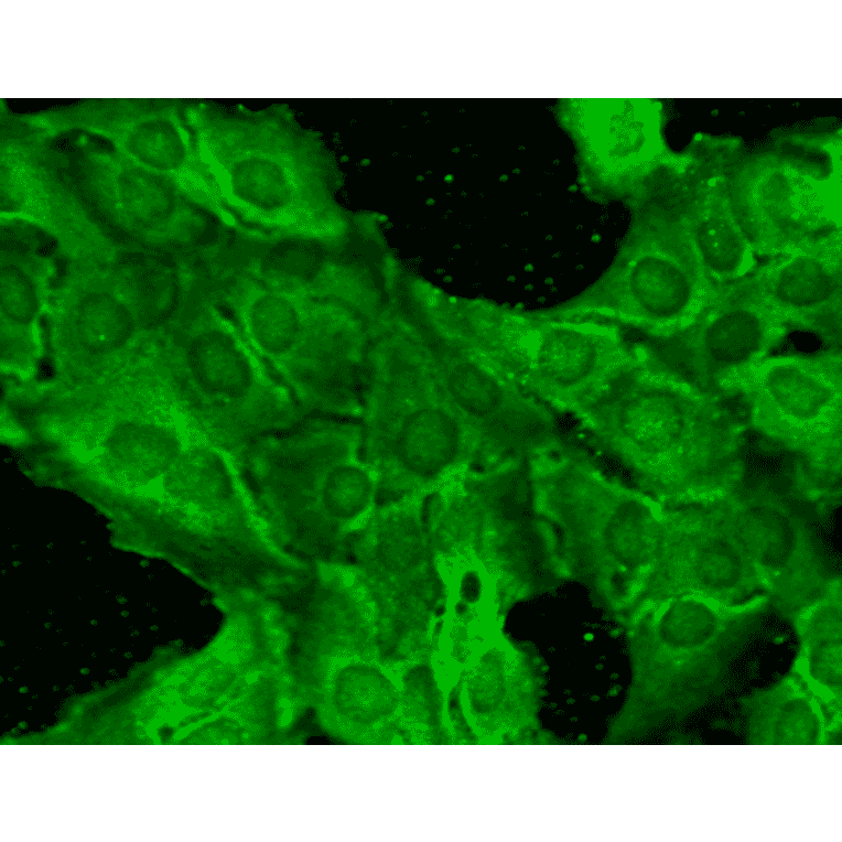 Immunocytochemistry/Immunofluorescence - Anti-NMDAR2B Antibody [S59] (A304796) - Antibodies.com