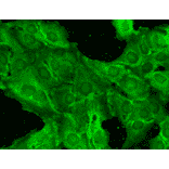 Immunocytochemistry/Immunofluorescence - Anti-NMDAR2B Antibody [S59] (A304796) - Antibodies.com
