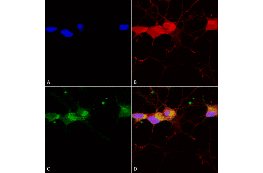 Immunocytochemistry/Immunofluorescence - Anti-NMDAR2B Antibody [S59] (A304796) - Antibodies.com