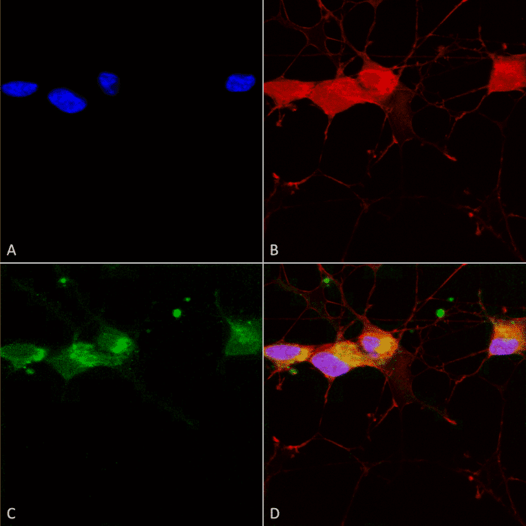Immunocytochemistry/Immunofluorescence - Anti-NMDAR2B Antibody [S59] (A304796) - Antibodies.com