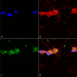 Immunocytochemistry/Immunofluorescence - Anti-NMDAR2B Antibody [S59] (A304796) - Antibodies.com