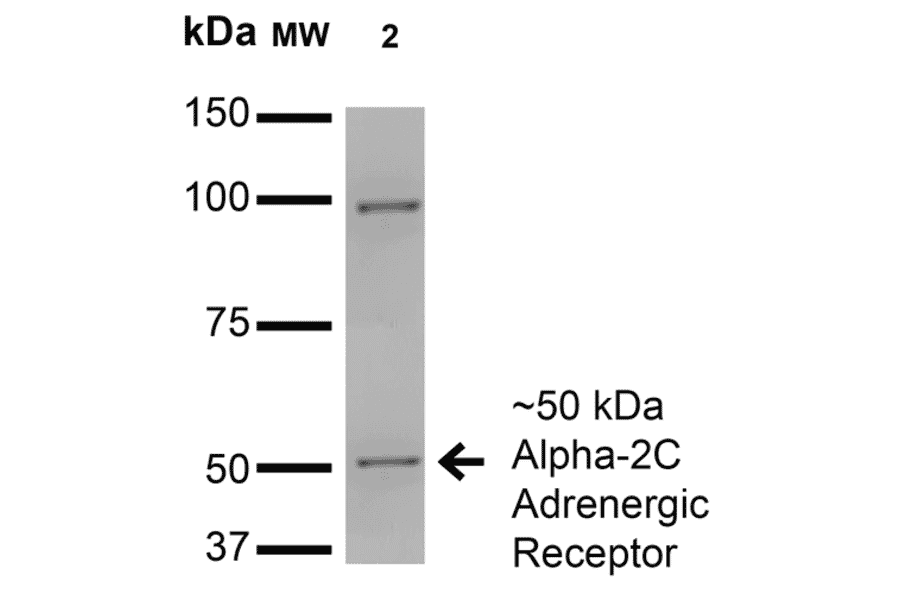 Western Blot - Anti-alpha 2C Adrenergic Receptor / ADRA2C Antibody [S330A-80] (A304797) - Antibodies.com