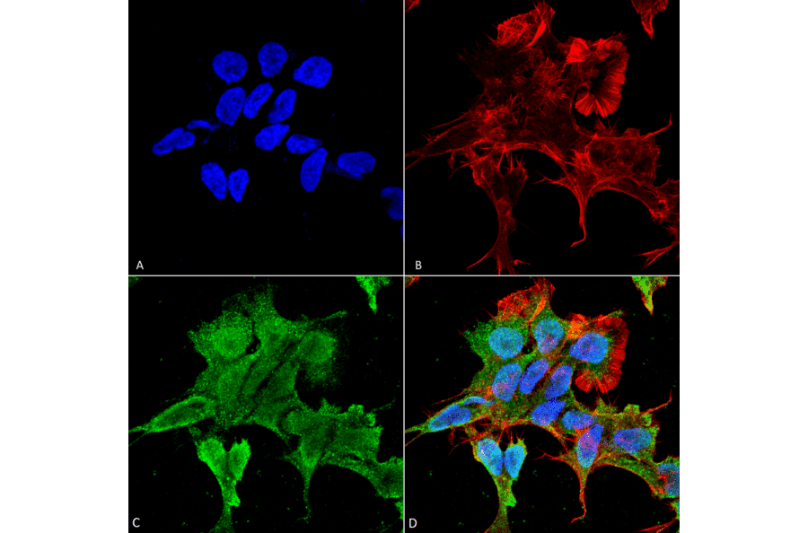Immunocytochemistry/Immunofluorescence - Anti-alpha 2C Adrenergic Receptor / ADRA2C Antibody [S330A-80] (A304797) - Antibodies.com