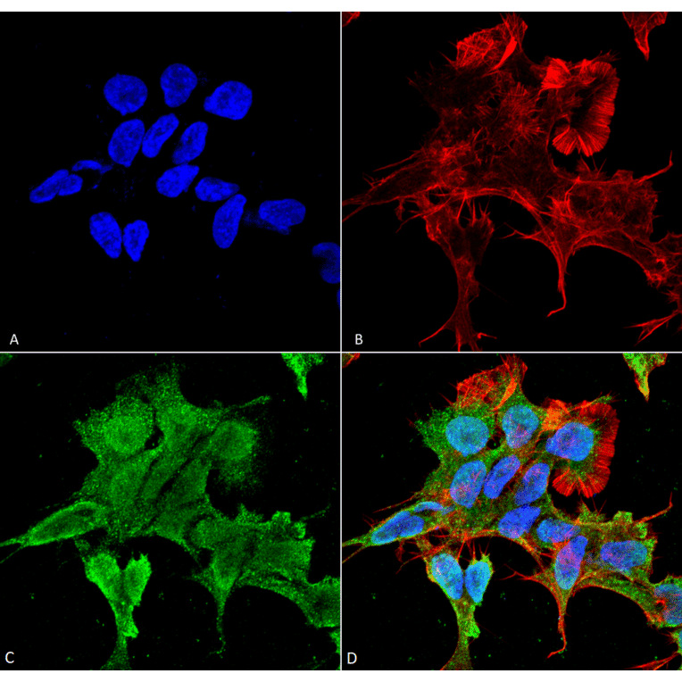 Immunocytochemistry/Immunofluorescence - Anti-alpha 2C Adrenergic Receptor / ADRA2C Antibody [S330A-80] (A304797) - Antibodies.com
