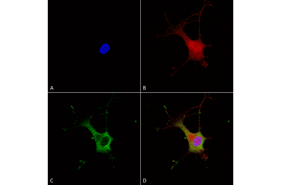 Immunocytochemistry/Immunofluorescence - Anti-alpha 2C Adrenergic Receptor / ADRA2C Antibody [S330A-80] (A304797) - Antibodies.com