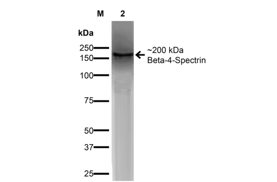 Western Blot - Anti-beta 4 Spectrin Antibody [S393-2] (A304798) - Antibodies.com