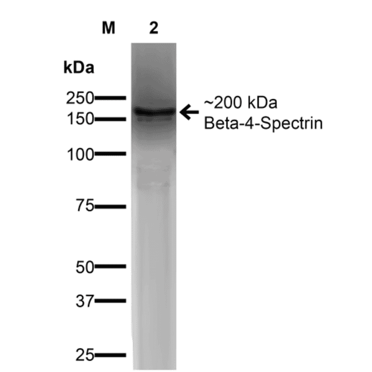 Western Blot - Anti-beta 4 Spectrin Antibody [S393-2] (A304798) - Antibodies.com