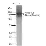 Western Blot - Anti-beta 4 Spectrin Antibody [S393-2] (A304798) - Antibodies.com