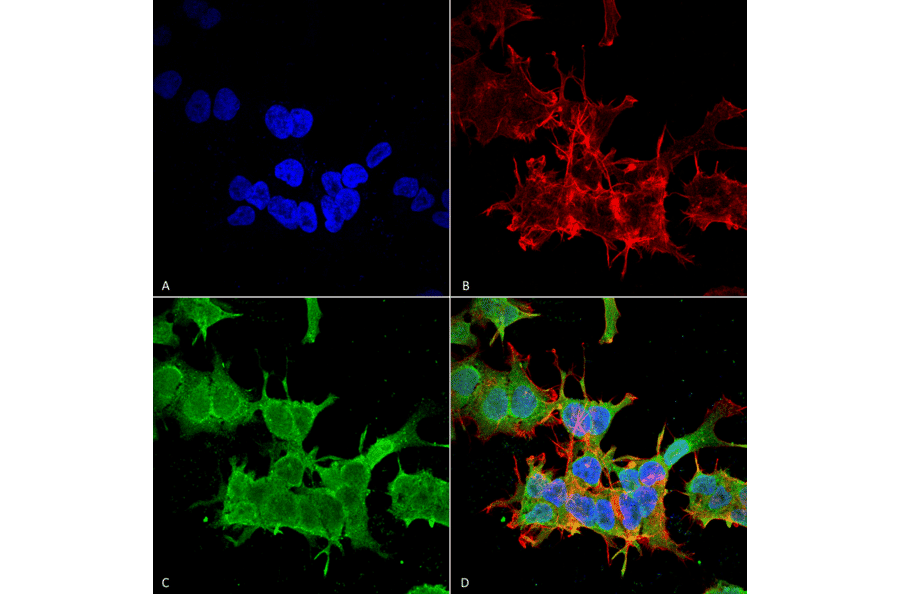 Immunocytochemistry/Immunofluorescence - Anti-beta 4 Spectrin Antibody [S393-2] (A304798) - Antibodies.com