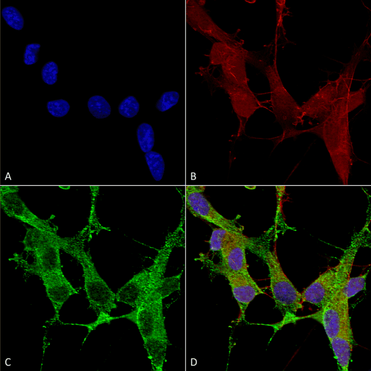 Immunocytochemistry/Immunofluorescence - Anti-beta 4 Spectrin Antibody [S393-2] (A304798) - Antibodies.com