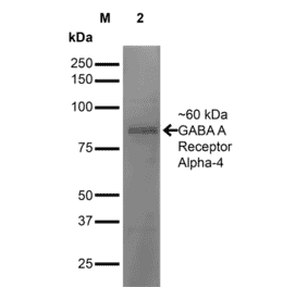 Western Blot - Anti-GABRA4 Antibody [S398A-34] (A304799) - Antibodies.com