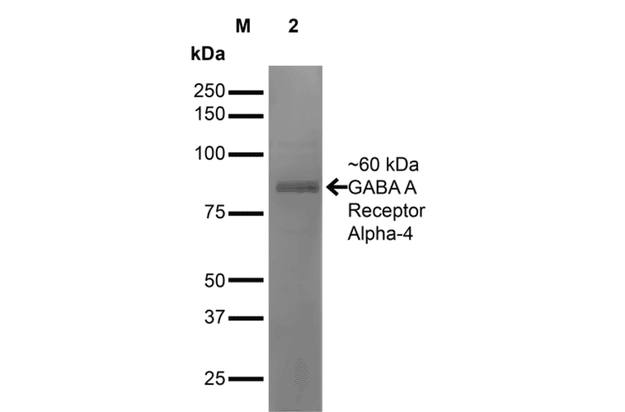 Western Blot - Anti-GABRA4 Antibody [S398A-34] (A304799) - Antibodies.com