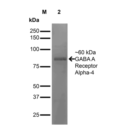 Western Blot - Anti-GABRA4 Antibody [S398A-34] (A304799) - Antibodies.com