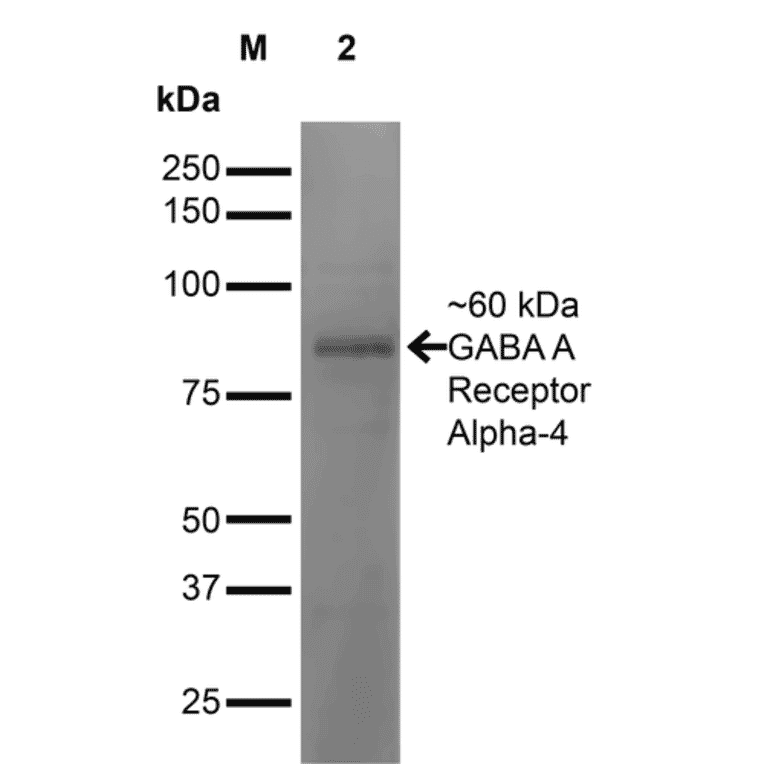 Western Blot - Anti-GABRA4 Antibody [S398A-34] (A304799) - Antibodies.com