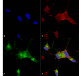 Immunocytochemistry/Immunofluorescence - Anti-Nav1.7 Antibody [N68/6] (A304801) - Antibodies.com