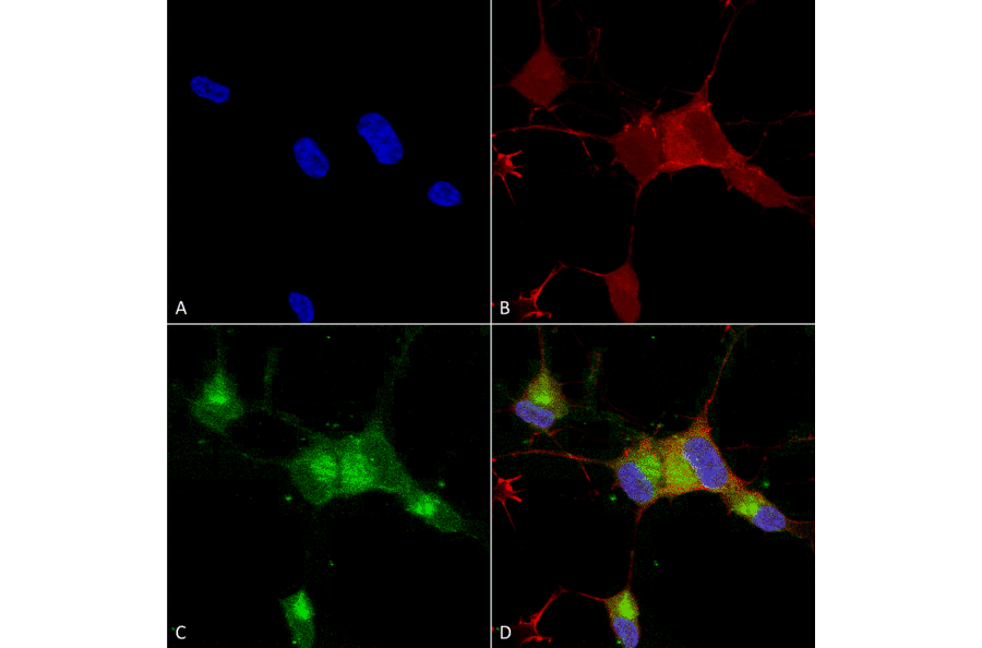 Immunocytochemistry/Immunofluorescence - Anti-Nav1.7 Antibody [N68/6] (A304801) - Antibodies.com