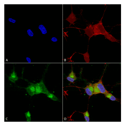 Immunocytochemistry/Immunofluorescence - Anti-Nav1.7 Antibody [N68/6] (A304801) - Antibodies.com