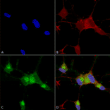 Immunocytochemistry/Immunofluorescence - Anti-Nav1.7 Antibody [N68/6] (A304801) - Antibodies.com