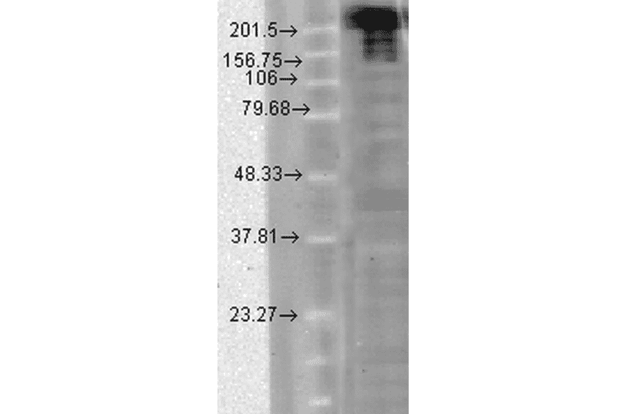 Western Blot - Anti-Nav1.7 Antibody [N68/6] (A304801) - Antibodies.com