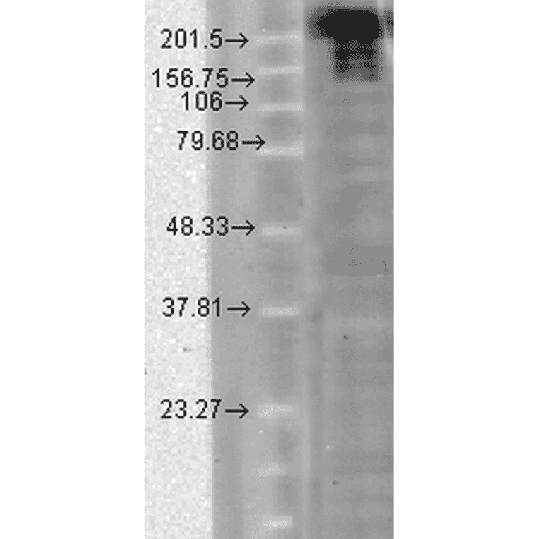 Western Blot - Anti-Nav1.7 Antibody [N68/6] (A304801) - Antibodies.com