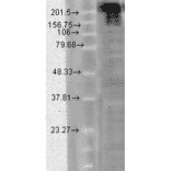 Western Blot - Anti-Nav1.7 Antibody [N68/6] (A304801) - Antibodies.com