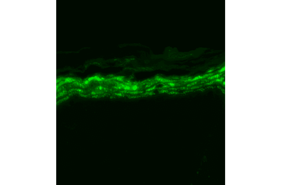 Immunohistochemistry - Anti-Nav1.7 Antibody [N68/6] (A304801) - Antibodies.com