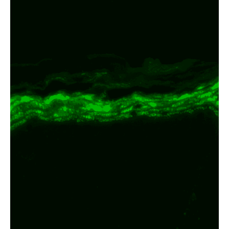 Immunohistochemistry - Anti-Nav1.7 Antibody [N68/6] (A304801) - Antibodies.com