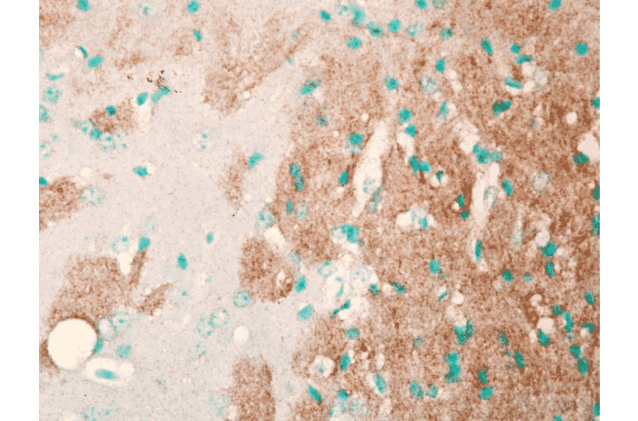 Immunohistochemistry - Anti-Nav1.7 Antibody [N68/6] (A304801) - Antibodies.com