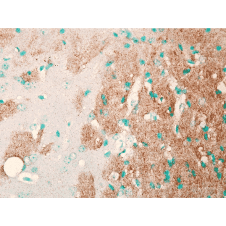 Immunohistochemistry - Anti-Nav1.7 Antibody [N68/6] (A304801) - Antibodies.com