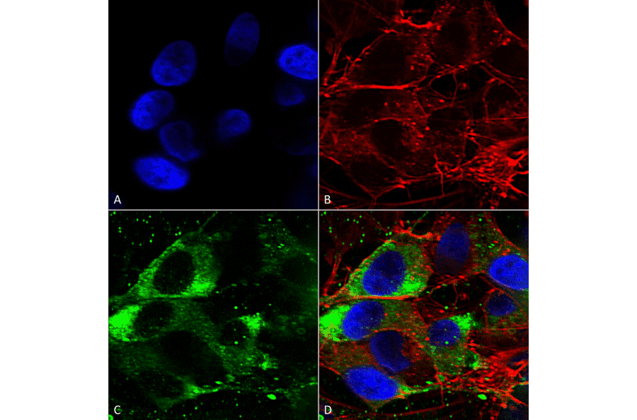 Immunocytochemistry/Immunofluorescence - Anti-Nav1.8 Antibody [S134] (A304802) - Antibodies.com