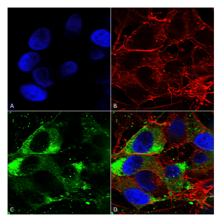 Immunocytochemistry/Immunofluorescence - Anti-Nav1.8 Antibody [S134] (A304802) - Antibodies.com