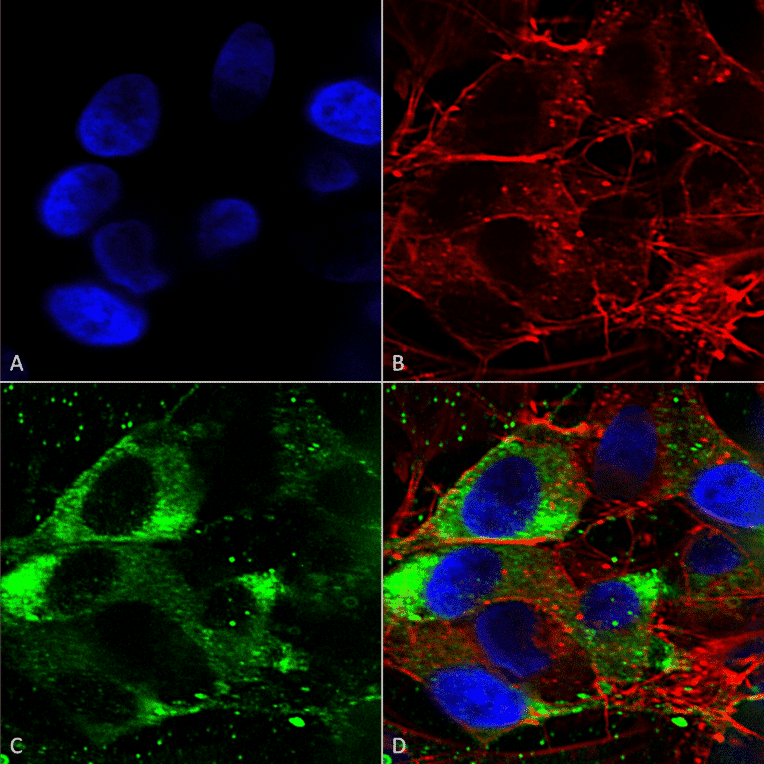 Immunocytochemistry/Immunofluorescence - Anti-Nav1.8 Antibody [S134] (A304802) - Antibodies.com