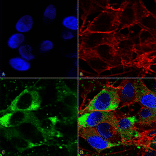 Immunocytochemistry/Immunofluorescence - Anti-Nav1.8 Antibody [S134] (A304802) - Antibodies.com