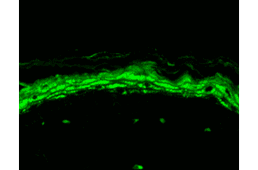 Immunohistochemistry - Anti-Nav1.8 Antibody [S134] (A304802) - Antibodies.com