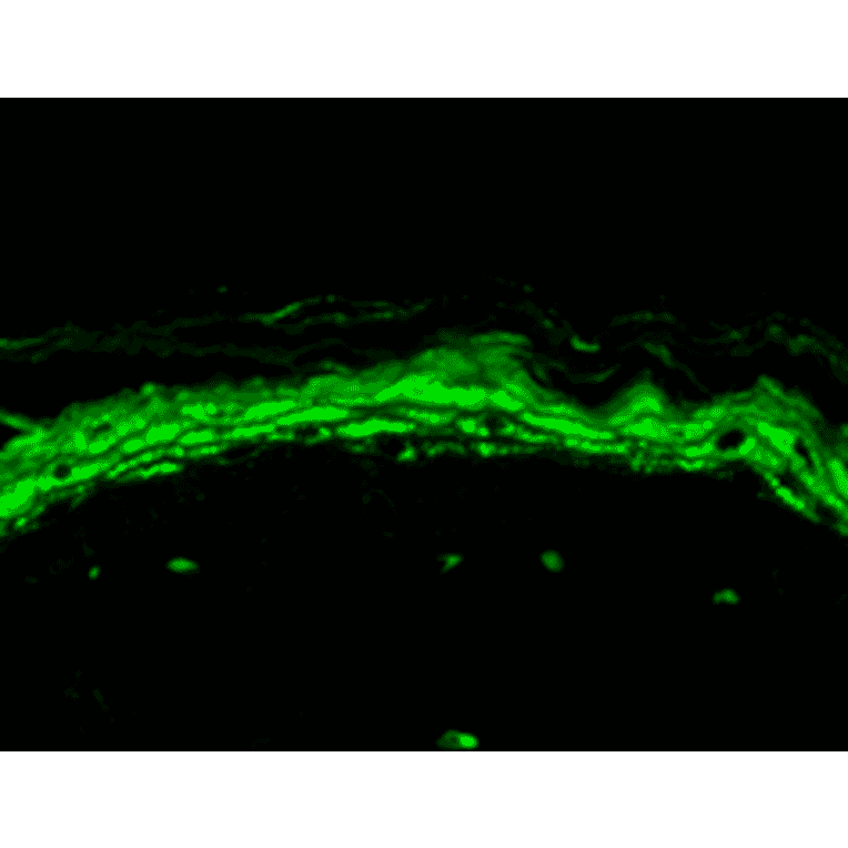 Immunohistochemistry - Anti-Nav1.8 Antibody [S134] (A304802) - Antibodies.com