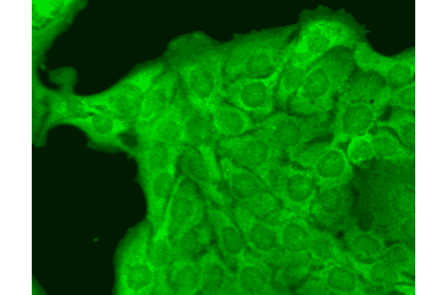 Immunocytochemistry/Immunofluorescence - Anti-Nav1.8 Antibody [S134] (A304802) - Antibodies.com