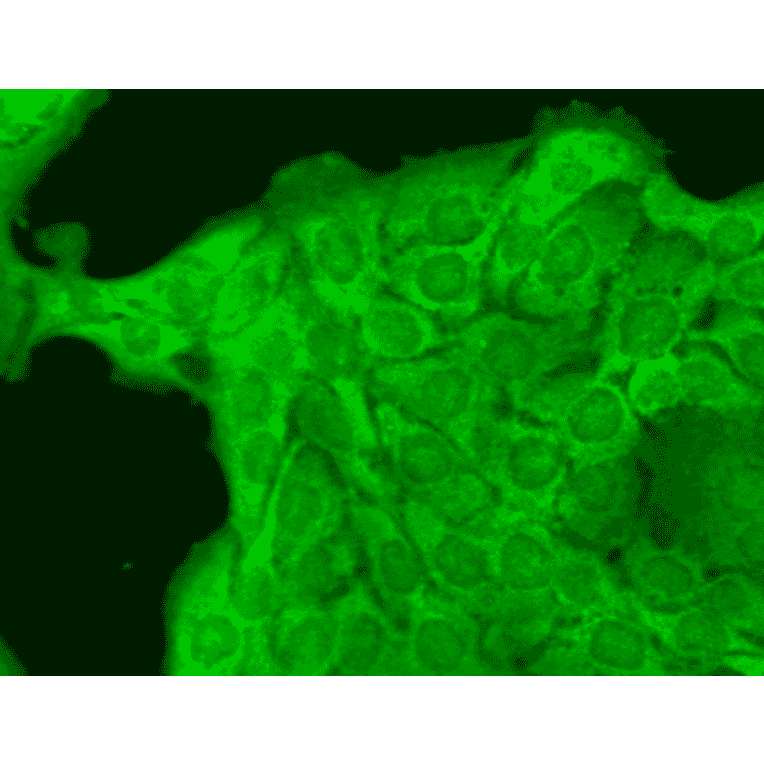 Immunocytochemistry/Immunofluorescence - Anti-Nav1.8 Antibody [S134] (A304802) - Antibodies.com