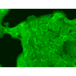 Immunocytochemistry/Immunofluorescence - Anti-Nav1.8 Antibody [S134] (A304802) - Antibodies.com