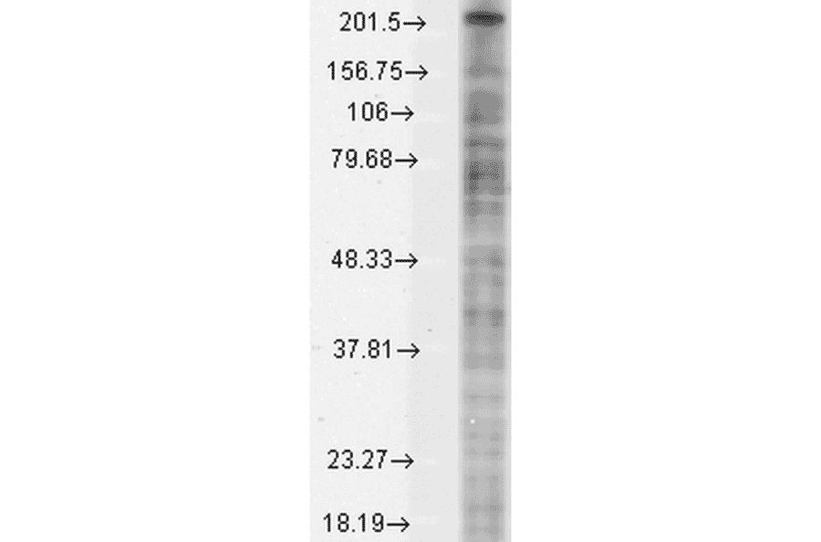 Western Blot - Anti-Nav1.8 Antibody [S134] (A304802) - Antibodies.com