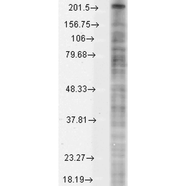 Western Blot - Anti-Nav1.8 Antibody [S134] (A304802) - Antibodies.com