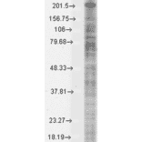 Western Blot - Anti-Nav1.8 Antibody [S134] (A304802) - Antibodies.com