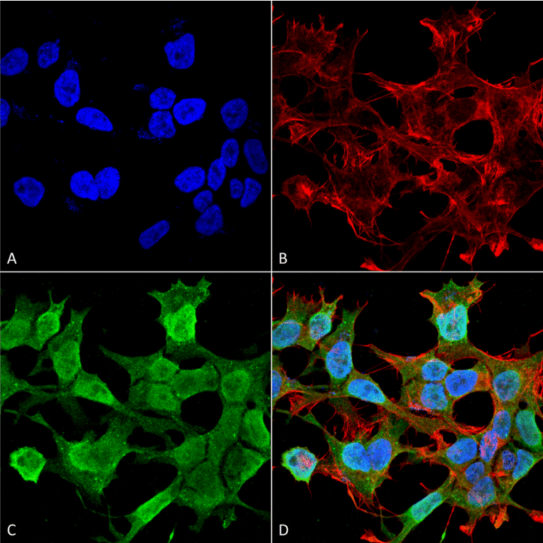 Immunocytochemistry/Immunofluorescence - Anti-Neuroligin 1 Antibody [S97A-31] (A304803) - Antibodies.com