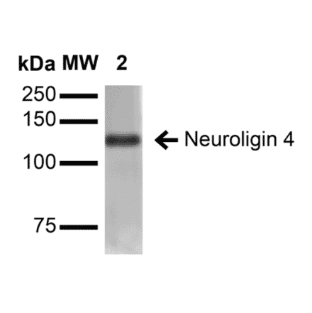 Western Blot - Anti-Neuroligin 4 Antibody [S98-7] (A304804) - Antibodies.com